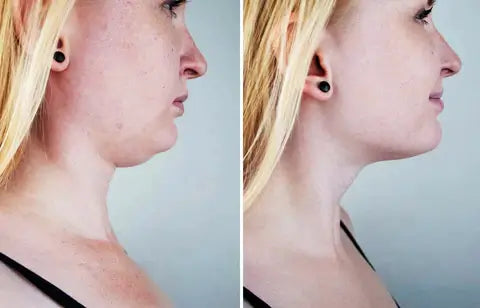 Gesichtsmassagegerät V Lifting-Bella Webshop