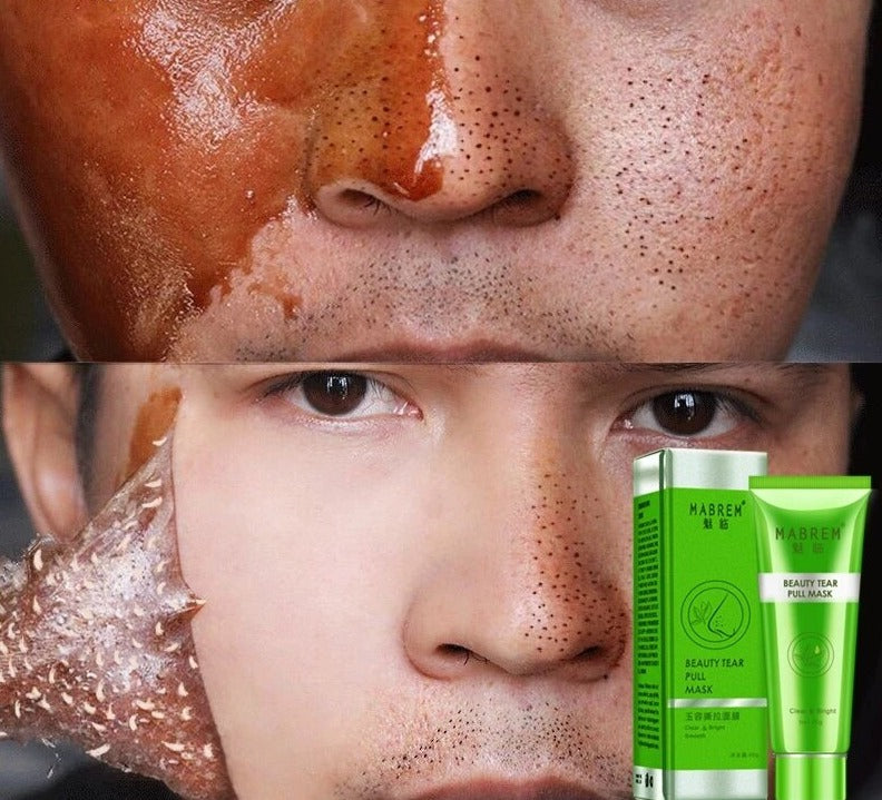 Mitesser-Entferner-Maske-Bella Webshop